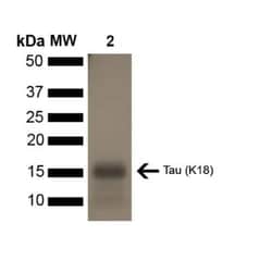 Novus Biologicals Recombinant Human Tau Active, (K18), P301L Mutant, Monomer Protein 5 x 100 &mu;g Vials | Buy Online | Novus Biologicals | Fisher Scientific
